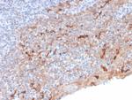 TIM3/HAVCR2/CD366 (Effector T-Cell Marker) Antibody in Immunohistochemistry (Paraffin) (IHC (P))