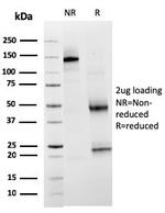 TIM3/HAVCR2/CD366 (Effector T-Cell Marker) Antibody in SDS-PAGE (SDS-PAGE)