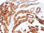 TIM3/HAVCR2/ CD366 (Effector T-Cell Marker) Antibody in Immunohistochemistry (Paraffin) (IHC (P))