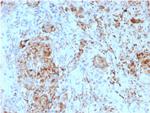 TIM3/HAVCR2/ CD366 (Effector T-Cell Marker) Antibody in Immunohistochemistry (Paraffin) (IHC (P))