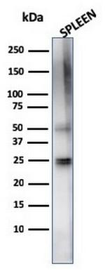 TIM3/HAVCR2/ CD366 (Effector T-Cell Marker) Antibody in Western Blot (WB)