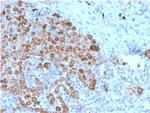 TIM3/HAVCR2/ CD366 (Effector T-Cell Marker) Antibody in Immunohistochemistry (Paraffin) (IHC (P))