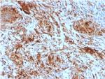 TIM3/HAVCR2/ CD366 (Effector T-Cell Marker) Antibody in Immunohistochemistry (Paraffin) (IHC (P))