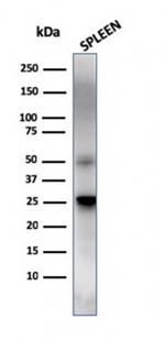 TIM3/HAVCR2/ CD366 (Effector T-Cell Marker) Antibody in Western Blot (WB)