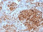 TIM3/HAVCR2/CD366 (Effector T-Cell Marker) Antibody in Immunohistochemistry (Paraffin) (IHC (P))