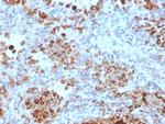 TIM3/HAVCR2/CD366 (Effector T-Cell Marker) Antibody in Immunohistochemistry (Paraffin) (IHC (P))