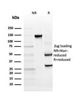 TIM3/HAVCR2/CD366 (Effector T-Cell Marker) Antibody in SDS-PAGE (SDS-PAGE)