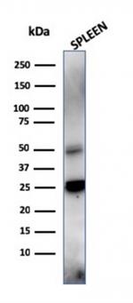 TIM3/HAVCR2/CD366 (Effector T-Cell Marker) Antibody in Western Blot (WB)