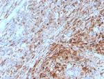 TIM3/HAVCR2/CD366 Antibody in Immunohistochemistry (Paraffin) (IHC (P))