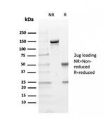 TIM3/HAVCR2/CD366 Antibody in SDS-PAGE (SDS-PAGE)