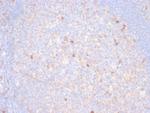 TIM3/HAVCR2/CD366 (Effector T-Cell Marker) Antibody in Immunohistochemistry (Paraffin) (IHC (P))