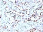 Prostein (p501S)/Solute Carrier Family 45 Member 3 (SLC45A3) Antibody in Immunohistochemistry (Paraffin) (IHC (P))