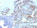 Prostein (p501S)/Solute Carrier Family 45 Member 3 (SLC45A3) Antibody in Immunohistochemistry (Paraffin) (IHC (P))