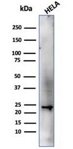 CBFB/PEBP2beta Antibody in Western Blot (WB)