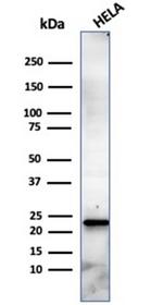 CBFB/PEBP2beta Antibody in Western Blot (WB)