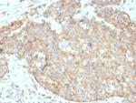 CD262/DR5 Antibody in Immunohistochemistry (Paraffin) (IHC (P))