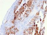 CD262/DR5 Antibody in Immunohistochemistry (Paraffin) (IHC (P))