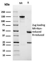 Sarcomeric Actinin Alpha 2/ACTN2 Antibody in SDS-PAGE (SDS-PAGE)