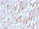 Sarcomeric Actinin Alpha 2/ACTN2 Antibody in Immunohistochemistry (Paraffin) (IHC (P))