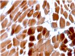 Sarcomeric Actinin Alpha 2/ACTN2 Antibody in Immunohistochemistry (Paraffin) (IHC (P))