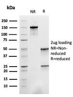 Sarcomeric Actinin Alpha 2/ACTN2 Antibody in SDS-PAGE (SDS-PAGE)