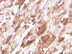 Sarcomeric Actinin Alpha 2/ACTN2 Antibody in Immunohistochemistry (Paraffin) (IHC (P))