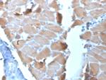 Sarcomeric Actinin Alpha 2/ACTN2 Antibody in Immunohistochemistry (Paraffin) (IHC (P))