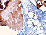 Sarcomeric Actinin Alpha 2/ACTN2 Antibody in Immunohistochemistry (Paraffin) (IHC (P))