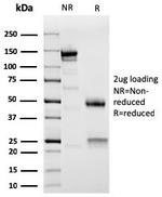 Sarcomeric Actinin Alpha 2/ACTN2 Antibody in SDS-PAGE (SDS-PAGE)