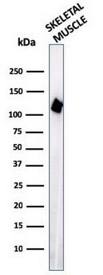 Sarcomeric Actinin Alpha 2/ACTN2 Antibody in Western Blot (WB)