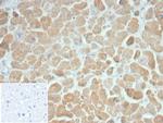 Sarcomeric Actinin Alpha 2/ACTN2 Antibody in Immunohistochemistry (Paraffin) (IHC (P))