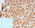 Sarcomeric Actinin Alpha 2/ACTN2 Antibody in Immunohistochemistry (Paraffin) (IHC (P))