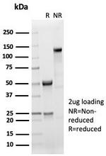 Sarcomeric Actinin Alpha 2/ACTN2 Antibody in SDS-PAGE (SDS-PAGE)