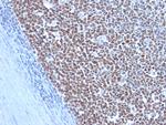 Cyclin B1 (G2- and M-phase Cyclin) Antibody in Immunohistochemistry (Paraffin) (IHC (P))