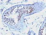 Cyclin B1 (G2- and M-phase Cyclin) Antibody in Immunohistochemistry (Paraffin) (IHC (P))