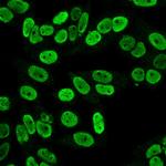 Cyclin B1 (G2- and M-phase Cyclin) Antibody in Immunocytochemistry (ICC/IF)