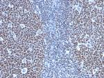 Cyclin B1 (G2- and M-phase Cyclin) Antibody in Immunohistochemistry (Paraffin) (IHC (P))