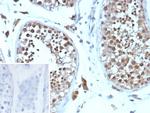 Cyclin B1 (G2- and M-phase Cyclin) Antibody in Immunohistochemistry (Paraffin) (IHC (P))