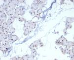 PHOX2B Antibody in Immunohistochemistry (Paraffin) (IHC (P))