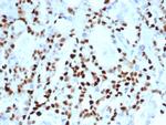 Cyclin E (G1/S-Phase Cyclin) Antibody in Immunohistochemistry (Paraffin) (IHC (P))