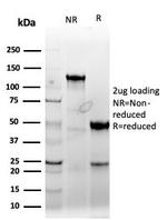 Cyclin E (G1/S-Phase Cyclin) Antibody in SDS-PAGE (SDS-PAGE)