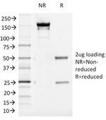 Aurora B Antibody in SDS-PAGE (SDS-PAGE)