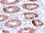 Aurora B Antibody in Immunohistochemistry (Paraffin) (IHC (P))