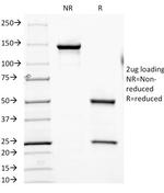 CD6 (Negative Marker of T-regulatory Cells) Antibody in SDS-PAGE (SDS-PAGE)