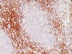 CD6 (Negative Marker of T-regulatory Cells) Antibody in Immunohistochemistry (Paraffin) (IHC (P))