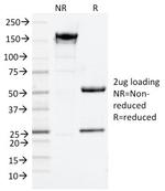 CD9 (TSPAN29) (Motility-Related Protein-1) Antibody in SDS-PAGE (SDS-PAGE)