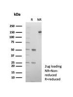 CD9 (TSPAN29) (Motility-Related Protein-1) Antibody in SDS-PAGE (SDS-PAGE)