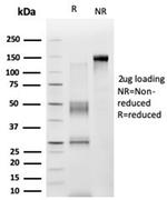 ZNF276 (Transcription Factor) Antibody in SDS-PAGE (SDS-PAGE)