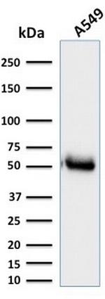 CD14 (Monocyte/Macrophage Marker) Antibody in Western Blot (WB)