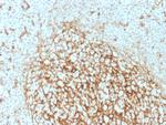 CD14 Antibody in Immunohistochemistry (Paraffin) (IHC (P))